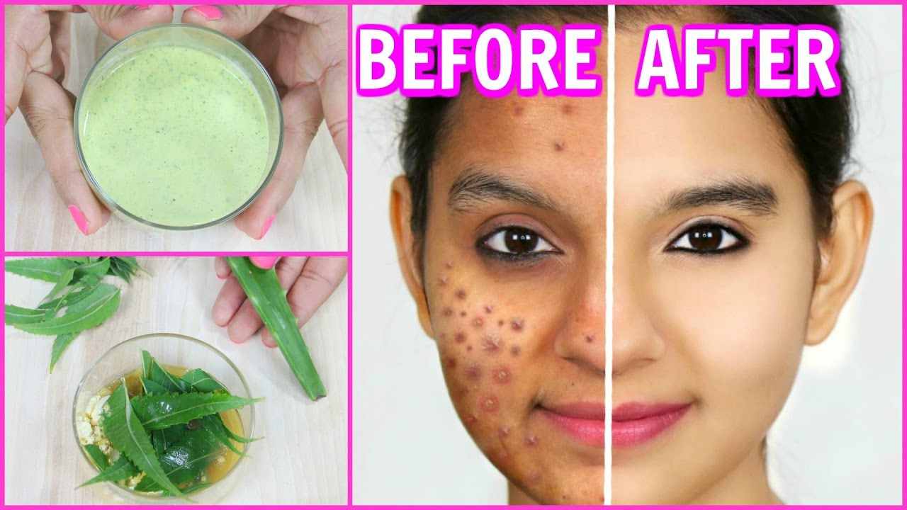 एलोवेरा और नीम की पत्ती एलोवेरा और नीम की पत्ती
