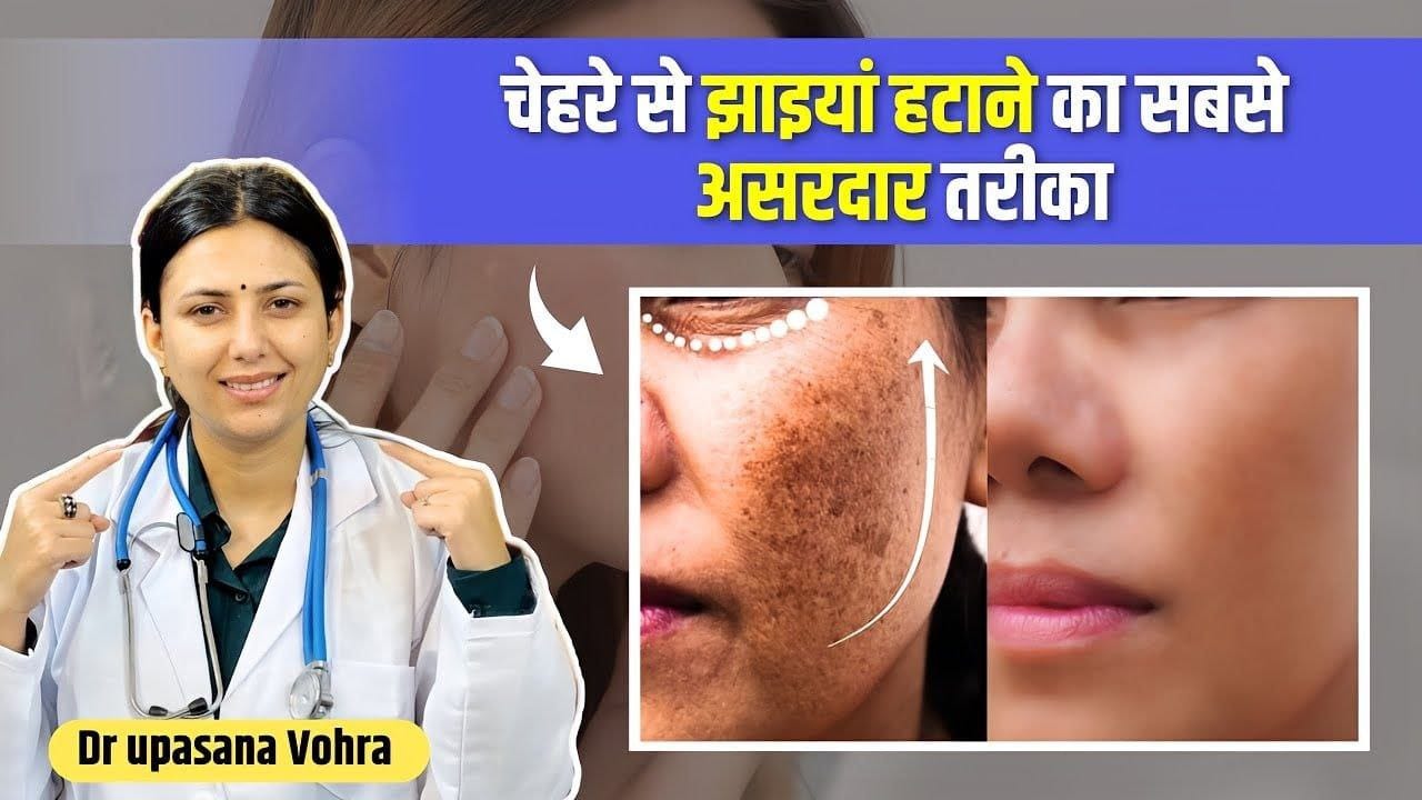 stop-pigmentation-causes-treatment-dr-upasana stop-pigmentation-causes-treatment-dr-upasana